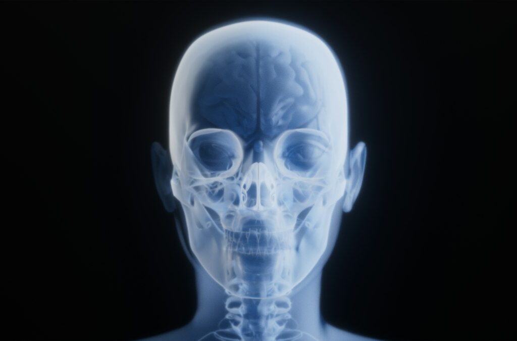 3D imaging of the head and upper neck