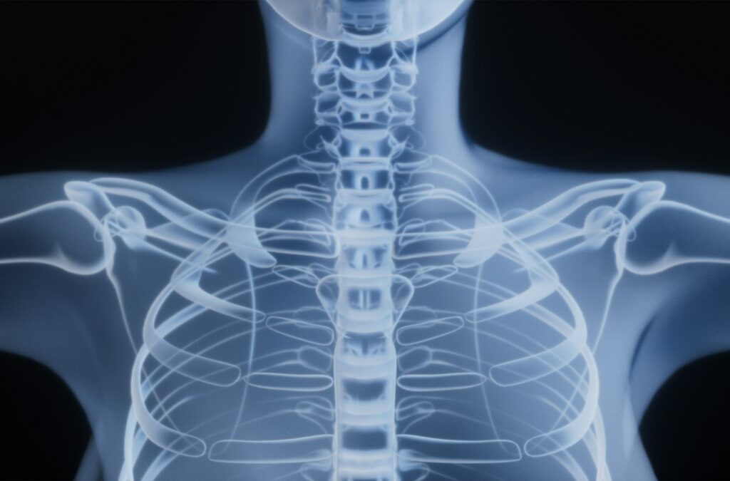 3D view of the cervical spine for Atlas Orthogonal analysis
